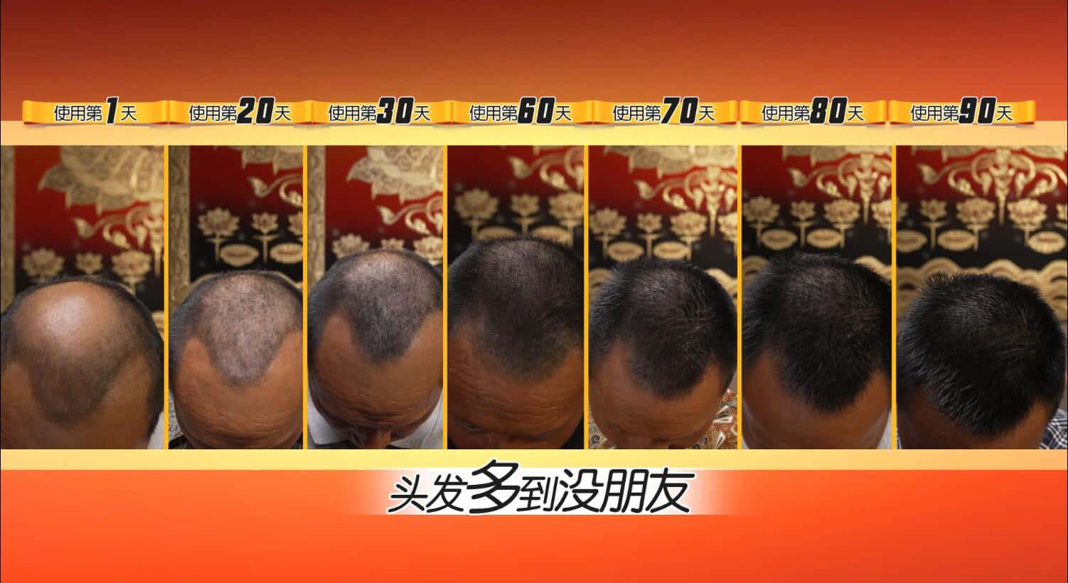 20220618132804955383.jpg 印尼苗人樘育发液5.jpg