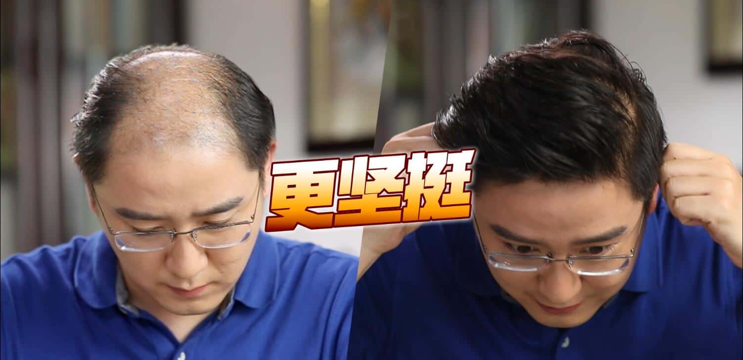 20220618132854629600.jpg 印尼苗人樘育发液12.jpg