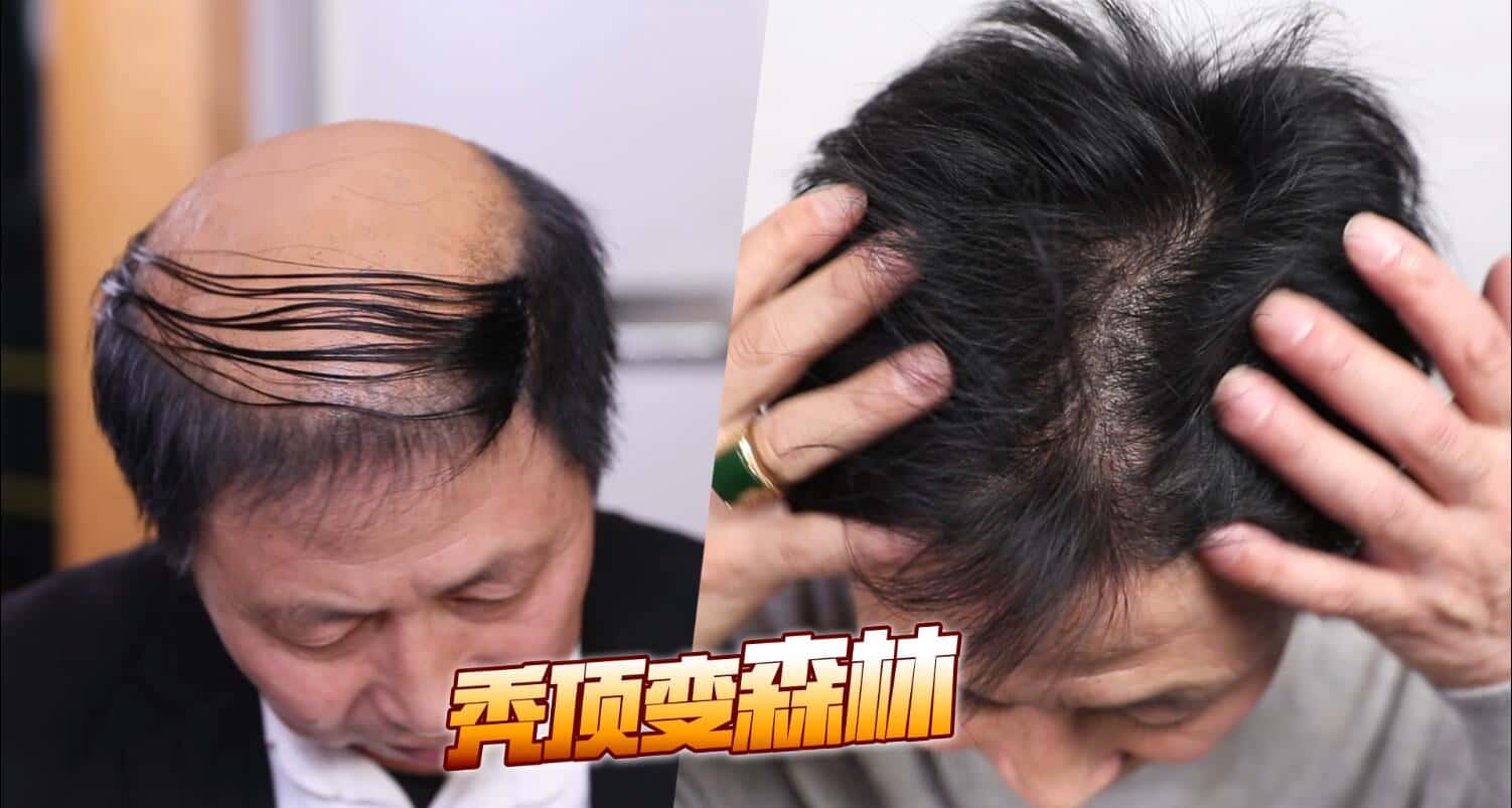 20220618132916952258.jpg 印尼苗人樘育发液15.jpg