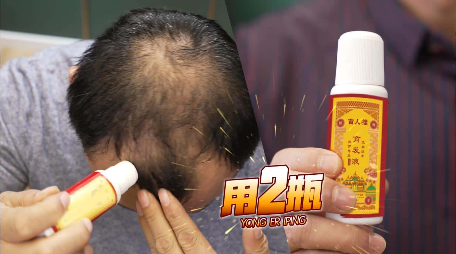 20220618132937288029.jpg 印尼苗人樘育发液18.jpg