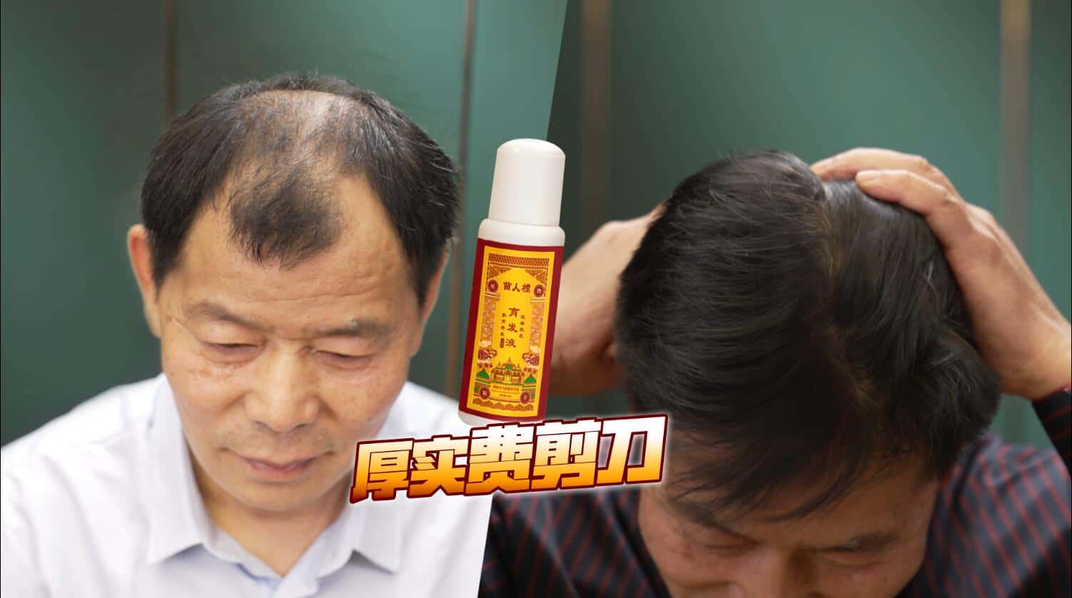 20220618132944698457.jpg 印尼苗人樘育发液19.jpg